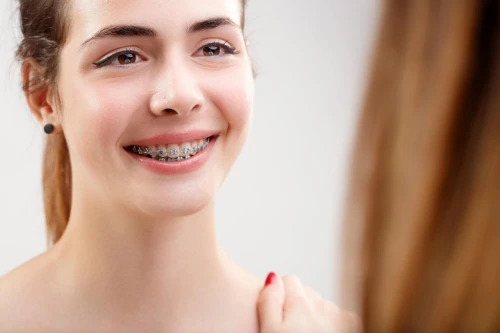 Some points to remember while undergoing orthodontic treatment