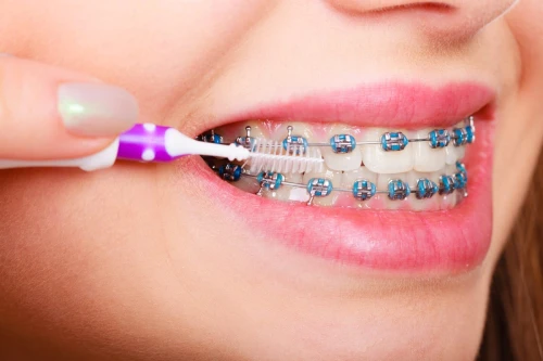 Oral health and Orthodontic treatment