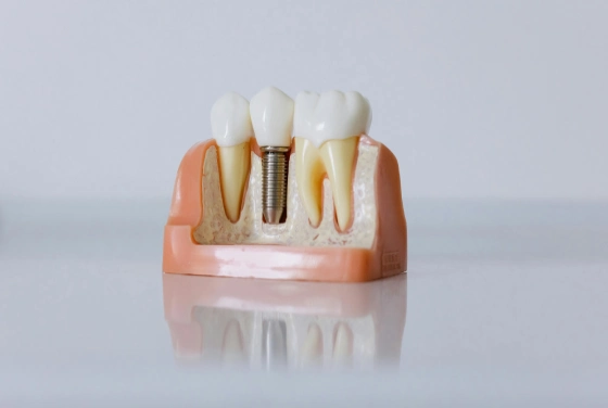 dental clinic in wakad
